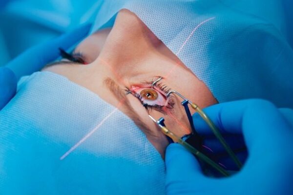 A close-up view of a patient undergoing LASIK Surgery, with a surgeon using specialized tools and a laser on the eye.